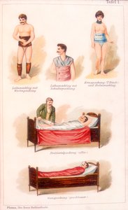 Tratamientos de hidroterapia de Unbekannt