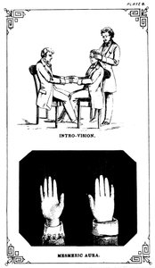 Hipnosis: poder de introvisión para ver dentro de un cuerpo, 1889