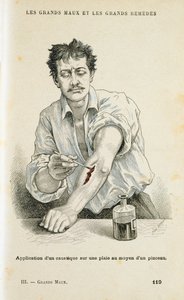 Pintando una herida con una solución antiséptica, c1890