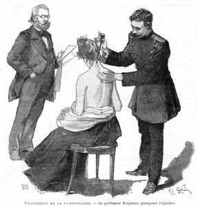 El profesor Bergmann inyectando a un paciente de tuberculosis, 1891 de Unbekannt