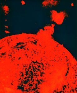 Erupción solar