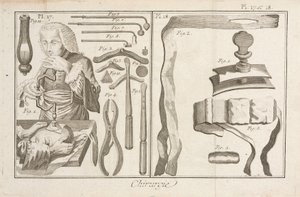 Trepanación de Unbekannt