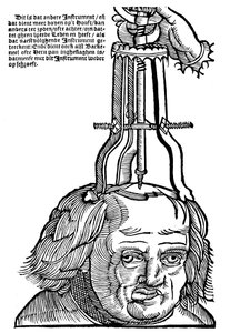 Trepanación, 1593
