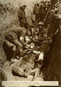 Soldado herido siendo tratado en las trincheras, Batalla del Somme, Primera Guerra Mundial, 1916 de Unbekannt