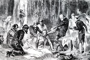 Ambroise Paré removiendo una lanza del rostro del Duque de Guisa de Unbekannt