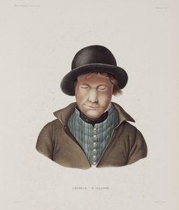 Enfermedades, Lepra Leproso masculino, Islandia, principios del siglo XIX