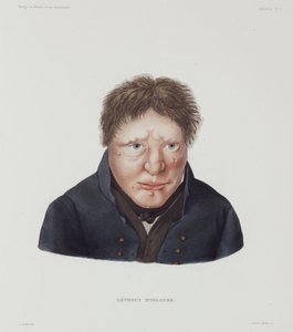 Enfermedades, Lepra Hombre leproso, Islandia, principios del siglo XIX de Unbekannt
