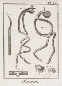 Equipamiento, Cirugía ocular de la Edad Moderna de Unbekannt