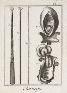 Equipamiento, Instrumentos quirúrgicos de la Edad Moderna y diagramas de partes del cuerpo de Unbekannt