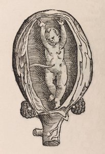 Partus non naturalis manibus funra canut porrectie