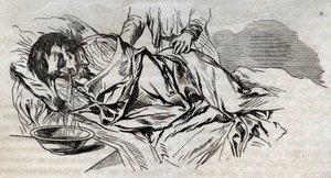 Medicina de accidentes - sobre el alivio más efectivo para dar a las personas ahogadas - los pañales de nuez en el costado y vomitando el agua que bebió - grabado en "La Santé Universelle - Guía Médica de las Familias" 1852