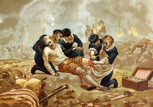 Ambroise Paré, médico y cirujano francés (c. 1509-1590) practica la ligadura de arterias después de la amputación. De Hombres y Mujeres Célebres. Barcelona 1877