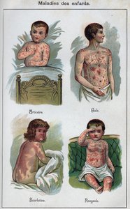 Enfermedades de los niños: Urticaria, sarampión, sarna, escarlatina. En “La nueva medicación natural” por F.E. Bilz de Unknown artist