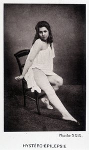 Hystero Epilepsie - Contractura en "Iconografía fotográfica de la Salpêtrière: servicio del Sr. Charcot" por Paul Regnard y Bourneville de Unknown artist