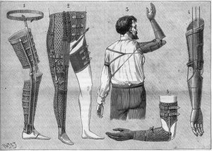 Aparatos modernos para amputados. 1) pierna artificial con cinturón, 2) aparato para desarticular el muslo, 3 y 4 brazos artificiales inventados y construidos por M.L Matthieu para el difunto Roger, 5) brazo artificial con mano, pulgar e índice. en "La nat de Unknown artist