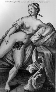 Niña hermafrodita vista en 1751 y dibujada del natural. de Unknown artist