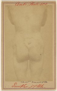 [Jno. E. Tucker, disparo en las nalgas, víctima de la Guerra Civil] de Unknown artist