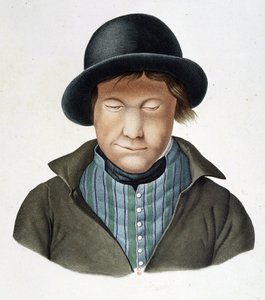 Leprosos de Islandia, circa 1840
