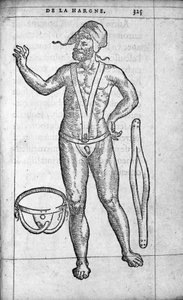 Medicina: un cinturón herniario. Grabado de “De la hargne” del médico y cirujano francés Ambroise Paré (1509-1590) siglo XVI
