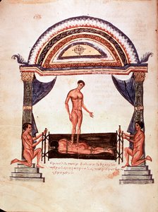 Medicina: reducción de una columna dislocada - el paciente está fijado en una tabla de madera, uno de los terapeutas se para sobre su espalda (manuscrito)