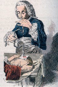 La trepanación. Estampa del siglo XVIII. de Unknown artist