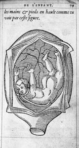 La posición del feto en el útero durante el embarazo. Grabado de “De la generación de los niños” del médico y cirujano francés Ambroise Paré (1509-1590) siglo XVI