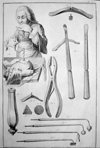 Trepanación del cráneo, varios instrumentos (grabado) de Unknown artist