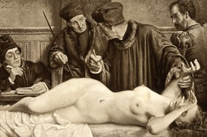 Brujería. Los científicos buscan un lunar en el cuerpo de una bruja, para pellizcarlo y estudiar la reacción. Ilustración de E. Van Hoove. 1888