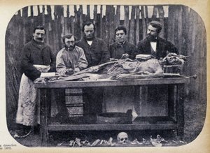 Disección, c.1865