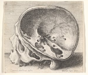 Cráneo seccionado en perfil a la izquierda con el lado izquierdo del cráneo removido, 1651 de Wenceslaus Hollar