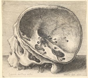 Cráneo seccionado en perfil hacia la izquierda con el lado izquierdo del cráneo removido de Wenceslaus Hollar