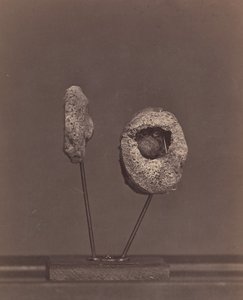 Articulación de rodilla excisada. Una bala de mosquete redonda en el cóndilo interno del fémur derecho, 1866-67