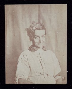 Psiquiatría Retrato de un paciente, Asilo del Condado de Surrey, c. 1852