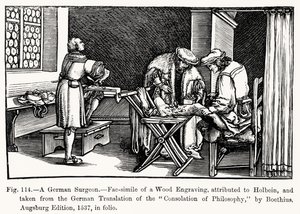 Un cirujano alemán, de Consolación de la Filosofía por Boecio, ilustración de Ciencia y Literatura en la Edad Media y el Renacimiento, escrito y grabado por Paul Lacroix, 1878 de after German School