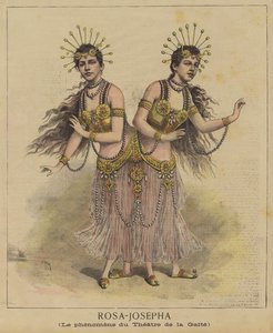 Gemelos siameses
