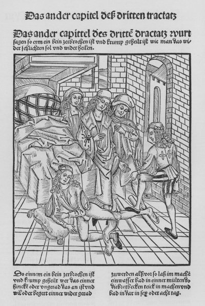 El libro de Cirurgia de Hieronymus Brunschwig de (after) German School