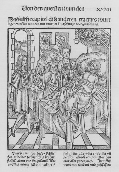 El libro de Cirurgia de Hieronymus Brunschwig de (after) German School