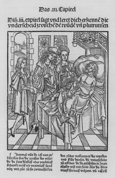 El libro de Cirurgia de Hieronymus Brunschwig de (after) German School