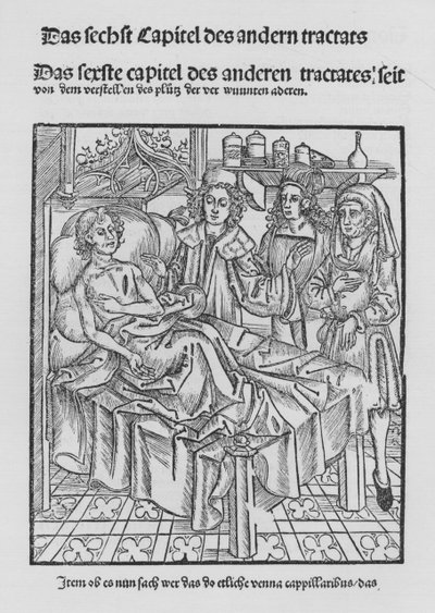 El libro de Cirurgia de Hieronymus Brunschwig de (after) German School