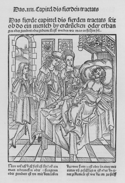 El Libro de Cirugía de Hieronymus Brunschwig de (after) German School