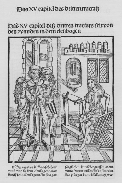 El Libro de Cirugía de Hieronymus Brunschwig de (after) German School
