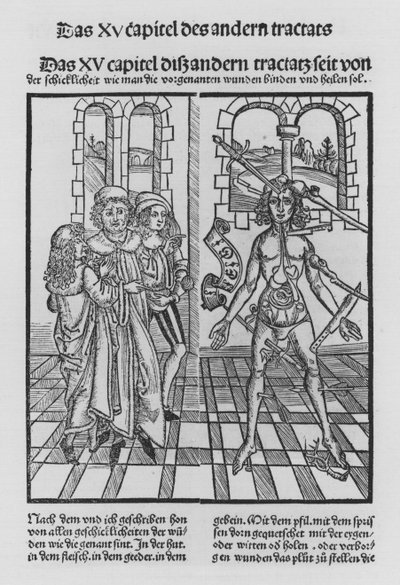 El libro de Cirugía de Hieronymus Brunschwig de (after) German School