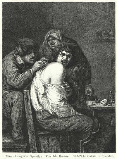 La Operación de Espalda de Adriaen (after) Brouwer