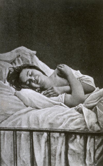 Joven mujer teniendo un ataque de histeria, 1878 de Albert Londe