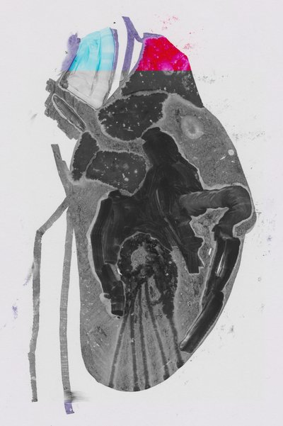 Media de Alexander Adiels