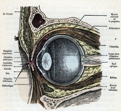 Corte vertical de un globo ocular con catarata Grabado de "Nature and Man" de Rengade 1881 Colección particular de Alphonse Demarle