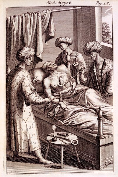 Ilustración de moxibustión de Medicina Aegyptorum por Prospero Alpinus, 1745 de American School