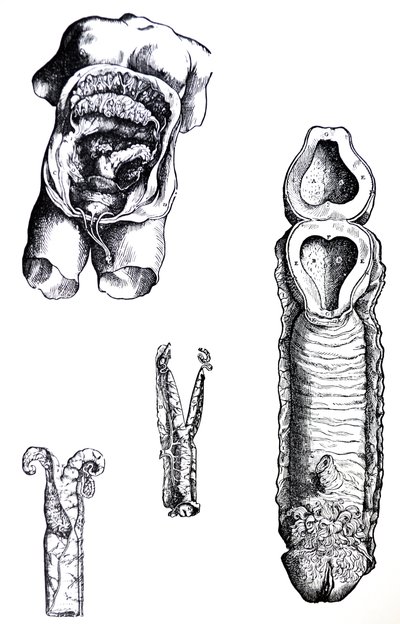 Las láminas del quinto libro de De Humani Corporis Fabrica de Andreas Vesalius