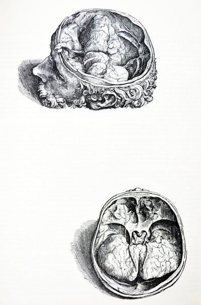 Las placas del séptimo libro de De Humani Corporis Fabrica de Andreas Vesalius