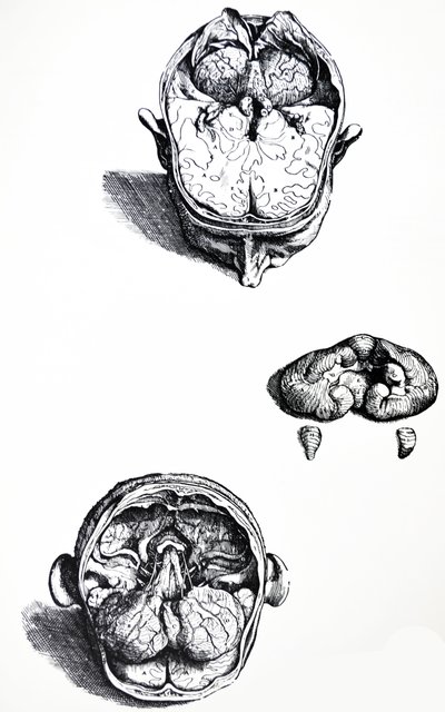 Las Placas del Séptimo Libro de De Humani Corporis Fabrica de Andreas Vesalius